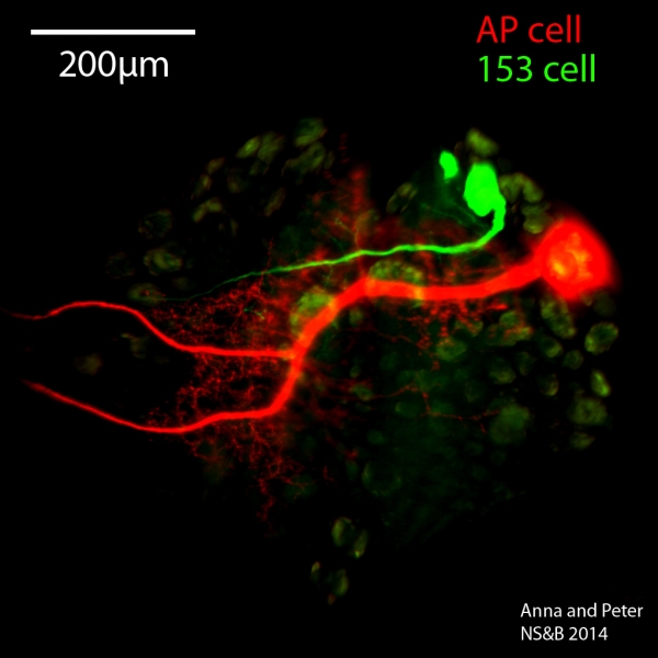 Dye-labeled leech neurons.