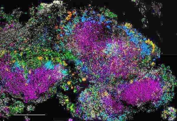 Hedgehog” structures of bacteria in dental plaque. MBL scientist Jessica Mark Welch has received a grant to expand this imaging technology to study microbiomes in other environments. Credit: Jessica Mark Welch