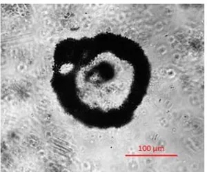 cyanobacteria Microcystis