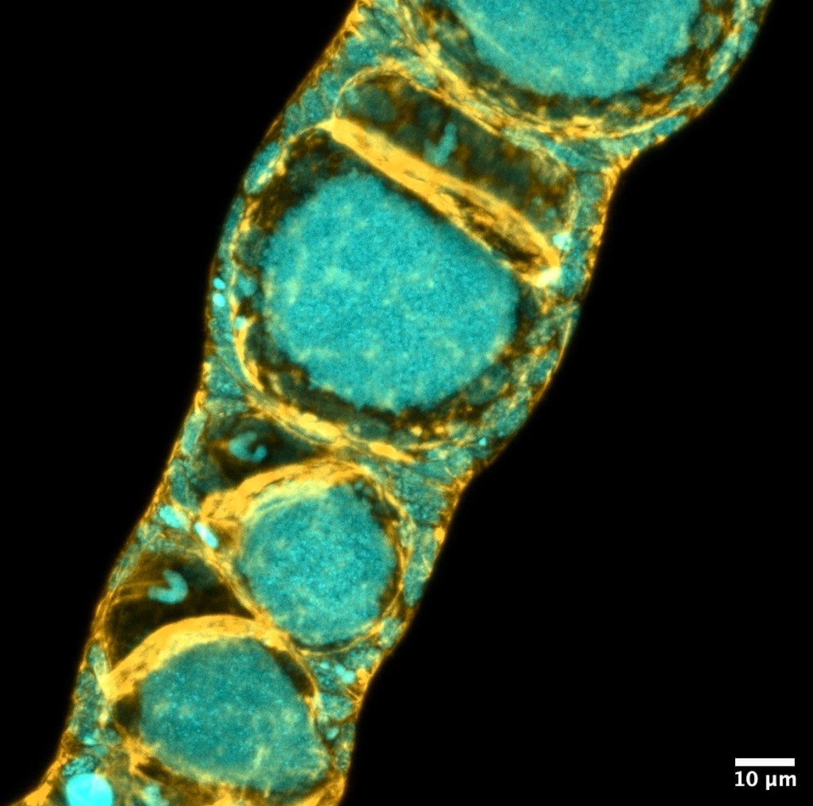 Earwig ovaries imaged on a Zeiss microscope during the 2022 Embryology course at the MBL. Credit: Corie Owen, PhD Candidate, UConn Health