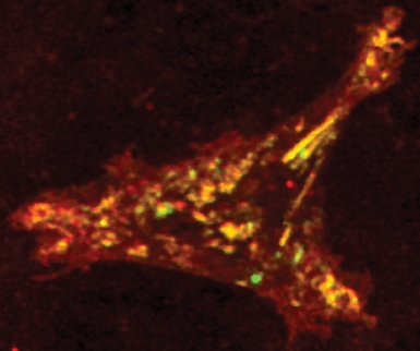 tarantula toxin