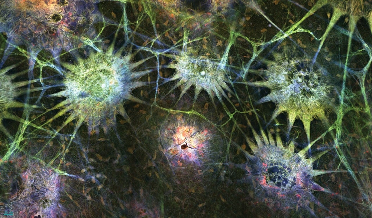 These starburst bunches are chromatophores on the adult squid’s skin, stained with antibodies. The radial projections are muscles, and the other connecting lines are likely nerves. The whole picture is only about a millimeter and a half across. Credit: Steve Senft