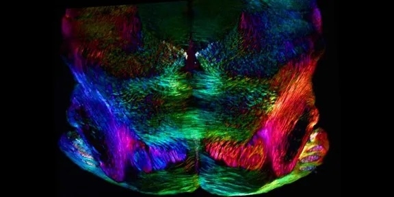 Mouse coronal brainstem, birefringence image. Credit: Michael Shribak and Timothy Balmer