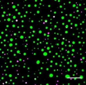 Distinct protein droplets form with different RNA. Scale bar is 10 um. Credit: EM Langdon et al, Science, 2018