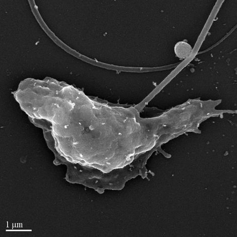 Scanning electron micrograph image of a chytrid zoospore, the stage of its life cycle when it uses a flagellum to swim. On the right is an extending pseudopod. The long, thin structure protruding from the top is a flagellum.