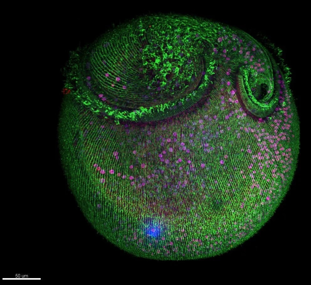 Microtubule structures in Stentor pyriformis. Credit: Victoria Yan, 2017 MBL Physiology course