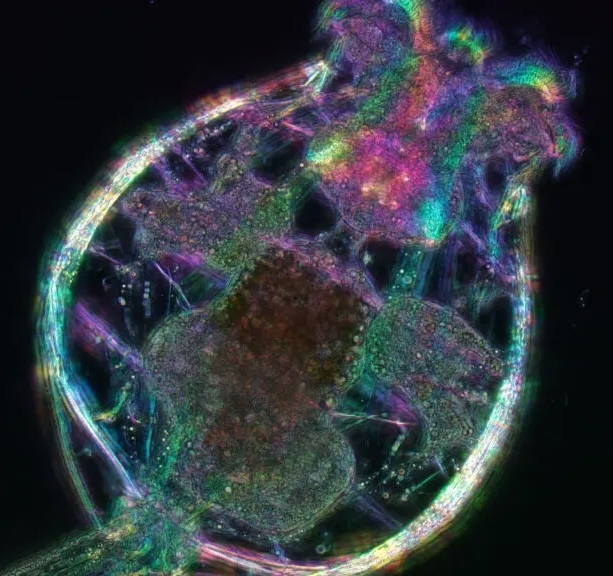 This young female rotifer is about 0.5 millimeters long, and has cilia (at the top) used for swimming and feeding, a large jaw for grinding food, a gut packed with brown algae, reproductive organs, bands of muscles running around the body, and a long, tail-like “foot” ending in two tiny toes. Michael Shribak and Kristin Gribble/Marine Biological Laboratory