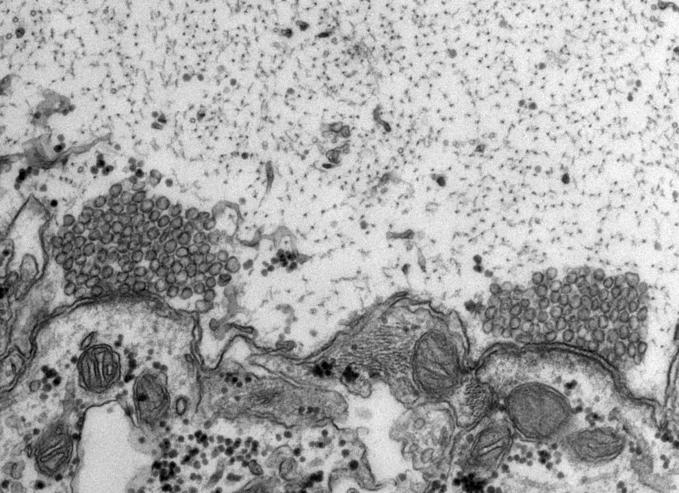 Sea lamprey synapse. Credit Paul Oliphint, Morgan Lab