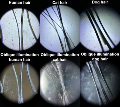 Images taken on cell phone attached to foldscope.