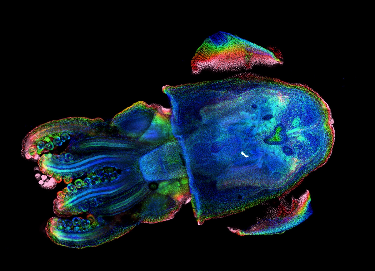 MBL Imagers Take Honors in Microscopy Contests | Marine Biological ...