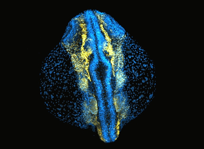 Migration of the zebrafish cranial neural crest