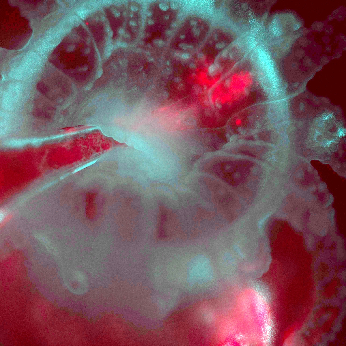 Using the L-SPI to visualize the re-infection of an Astrangia polyp (cyan from reflected light) with algae (red from chlorophyll fluorescence), injected by pipette into the mouth of the polyp. 