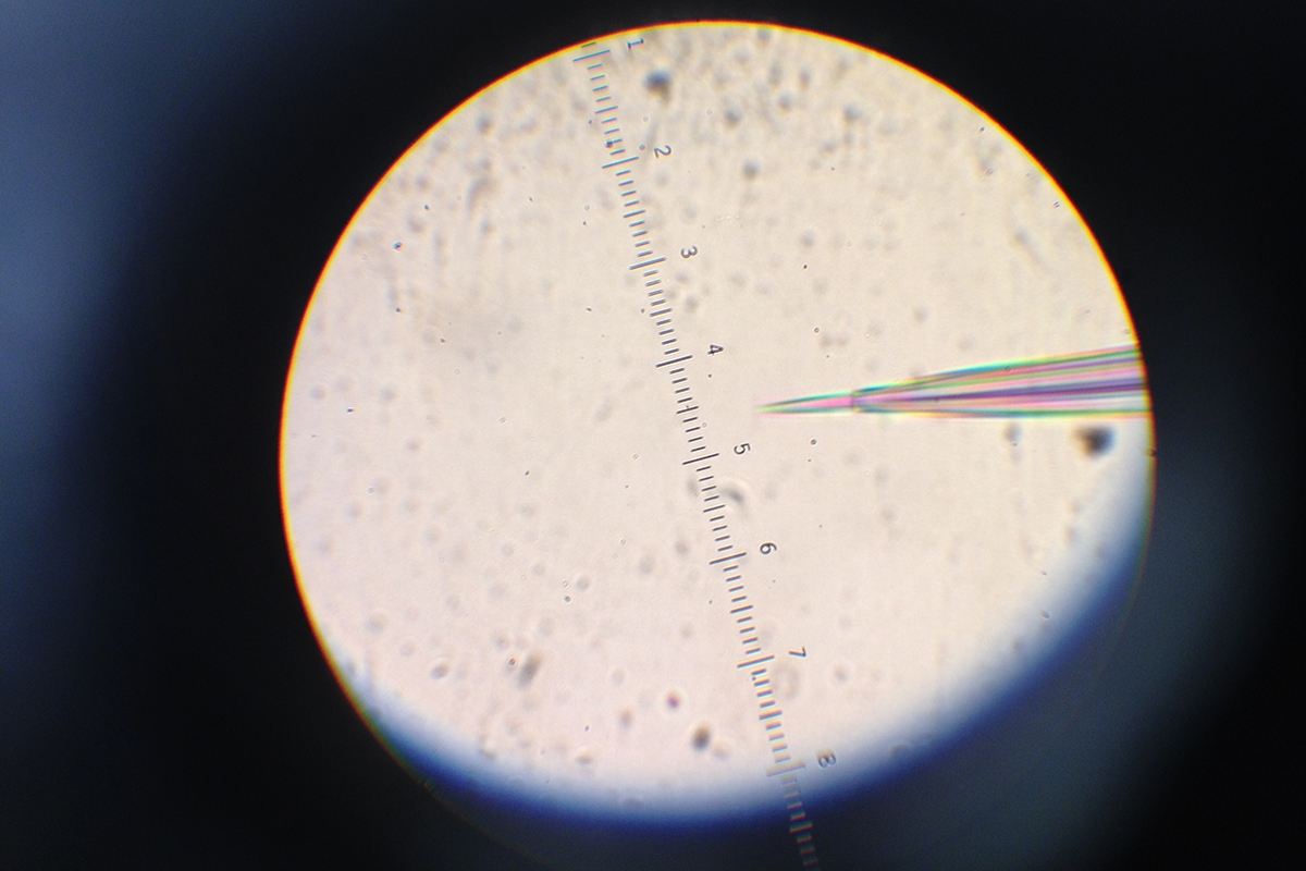 Liz Jonas’ pipette-within-pipette technique for measuring electrical activity inside organelles inside cells.