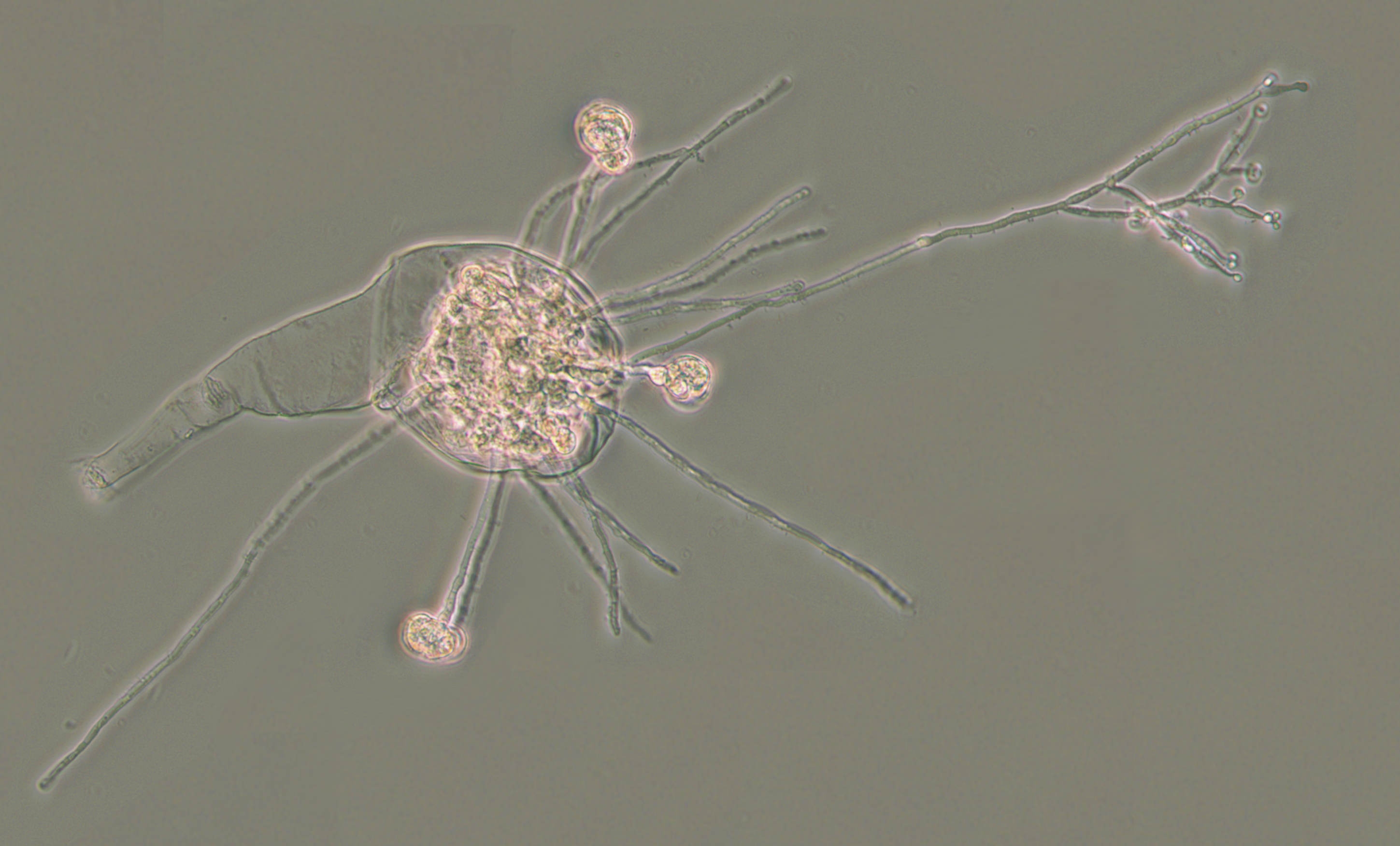 An infected rotifer. Like other animals, rotifers need strategies to fight off infections and avoid ending up like this diseased individual, which has been taken over and killed by a fungus. Credit: C. G. Wilson