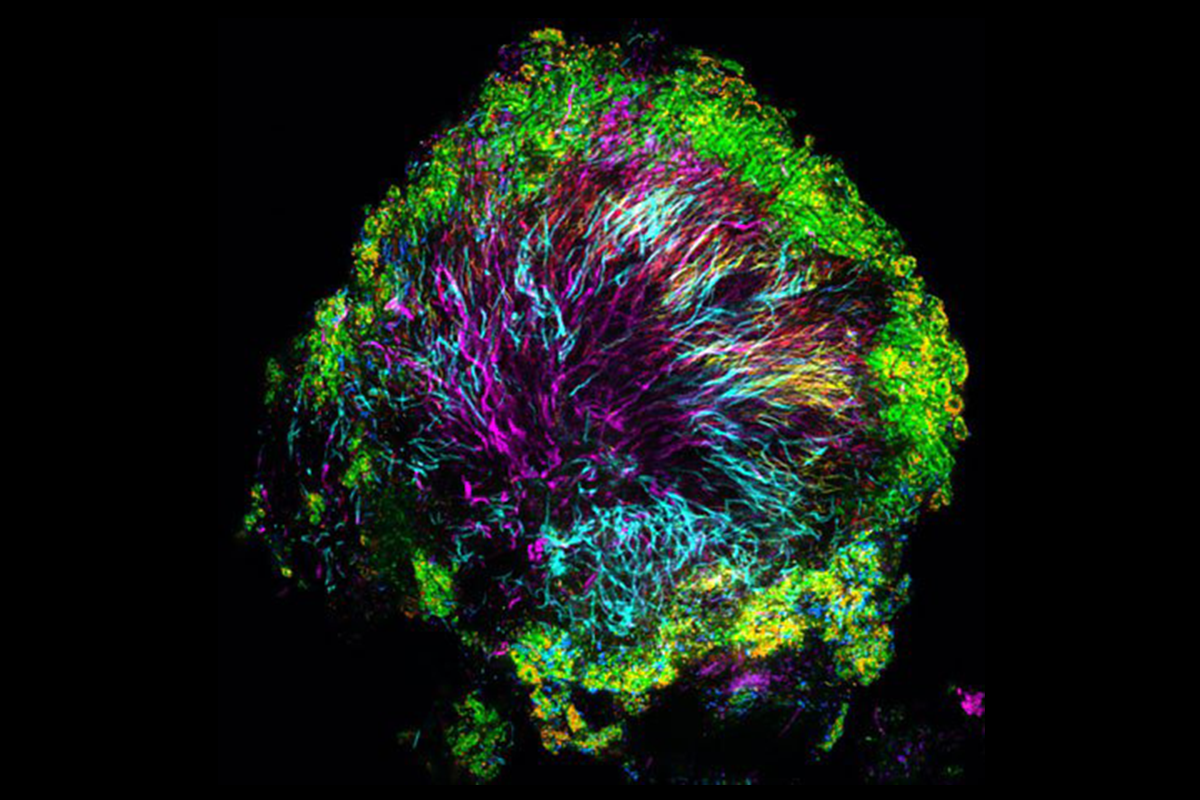 A “hedgehog” structure in dental plaque, collected from a healthy volunteer using a toothpick. Corynebacteria, shown in magenta, form the core of the structure; other bacteria inhabit the structure at characteristic positions. Photo credit: Jessica Mark Welch, MBL