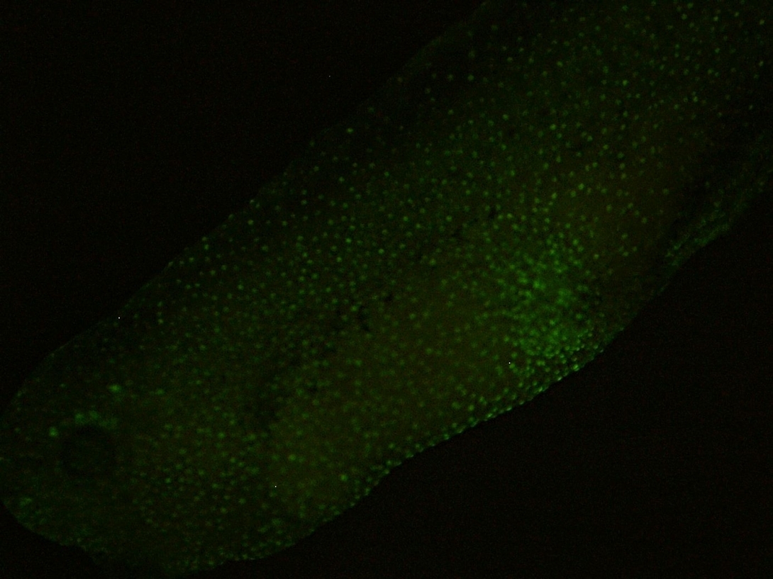 EB3GFP