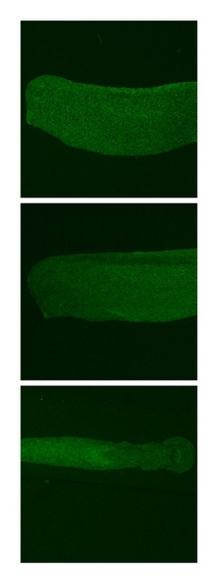 bCat-Elas-GFPassembled