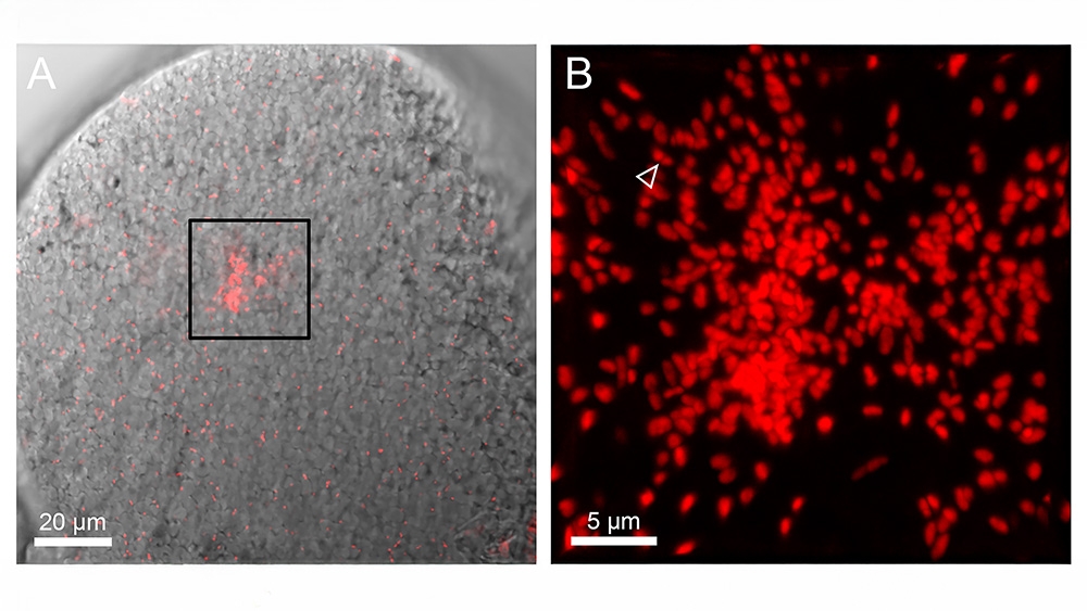 ostracod ovaries with endosymbiotic bacteria