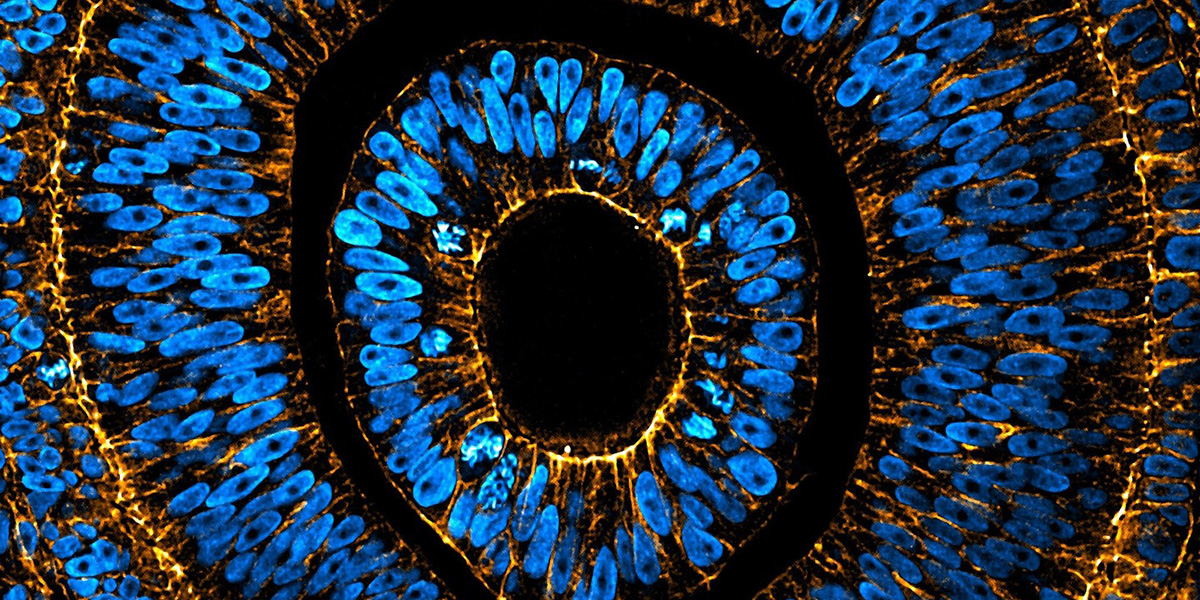 Embryonic eye of an Anole lizard stained for nuclei (DAPI, blue) and F-actin (Phalloidin, orange), imaged by spinning disc confocal microscopy and processed using ImageJ.
