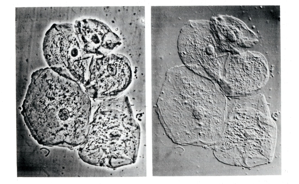 Two side-by-side magnified images of oral mucus