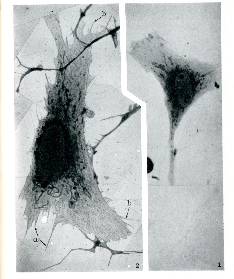 Newly-visible views of endoplasmic reticulum, thanks to EM