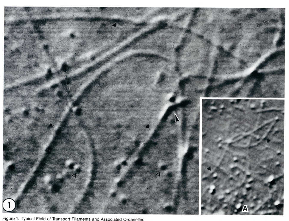 Magnified view of vesicles