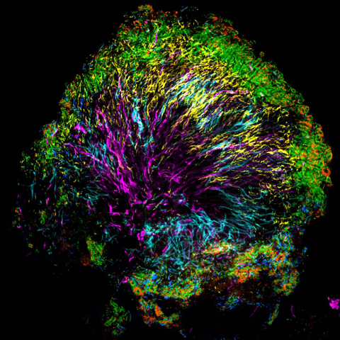 Microscopic image of a tree structure of bacteria.