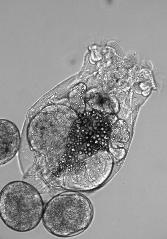 A rotifer under the microscope 