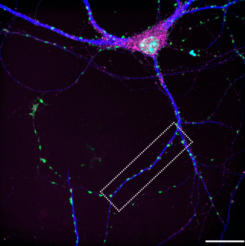 Microscopy image of a neuron 