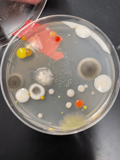 plate inoculated with student's breath