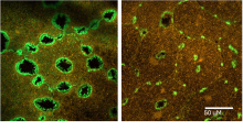 Two microscopy images of a wound closing