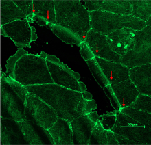 Microscopic image of a wound closing.