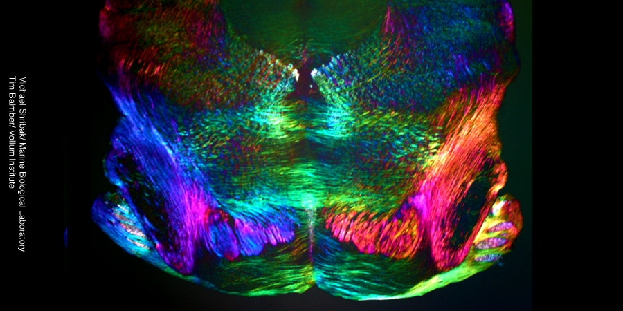 coronal-brainstem