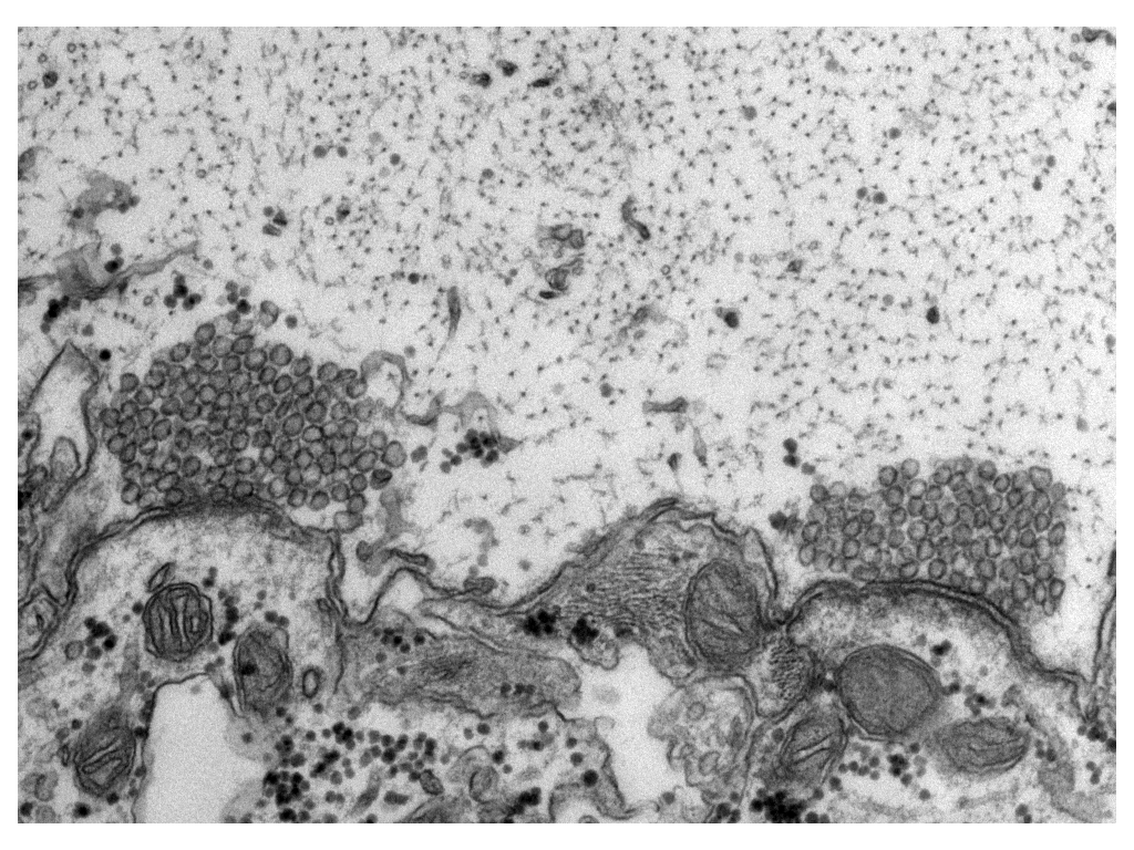 Electron micrograph showing two giant synapses within the lamprey spinal cord