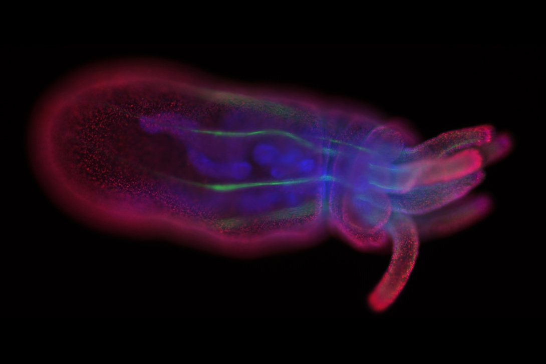 Wholemount staining of a growing Nematostella. 