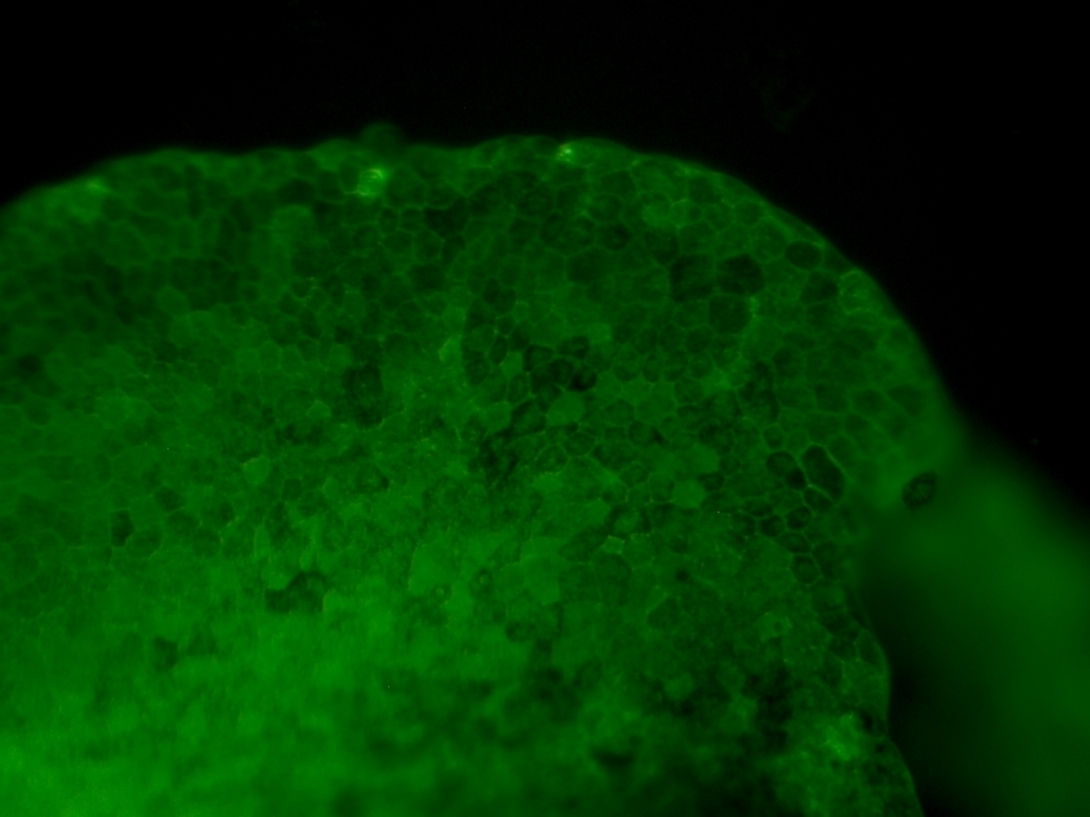 CMVmemGFP1