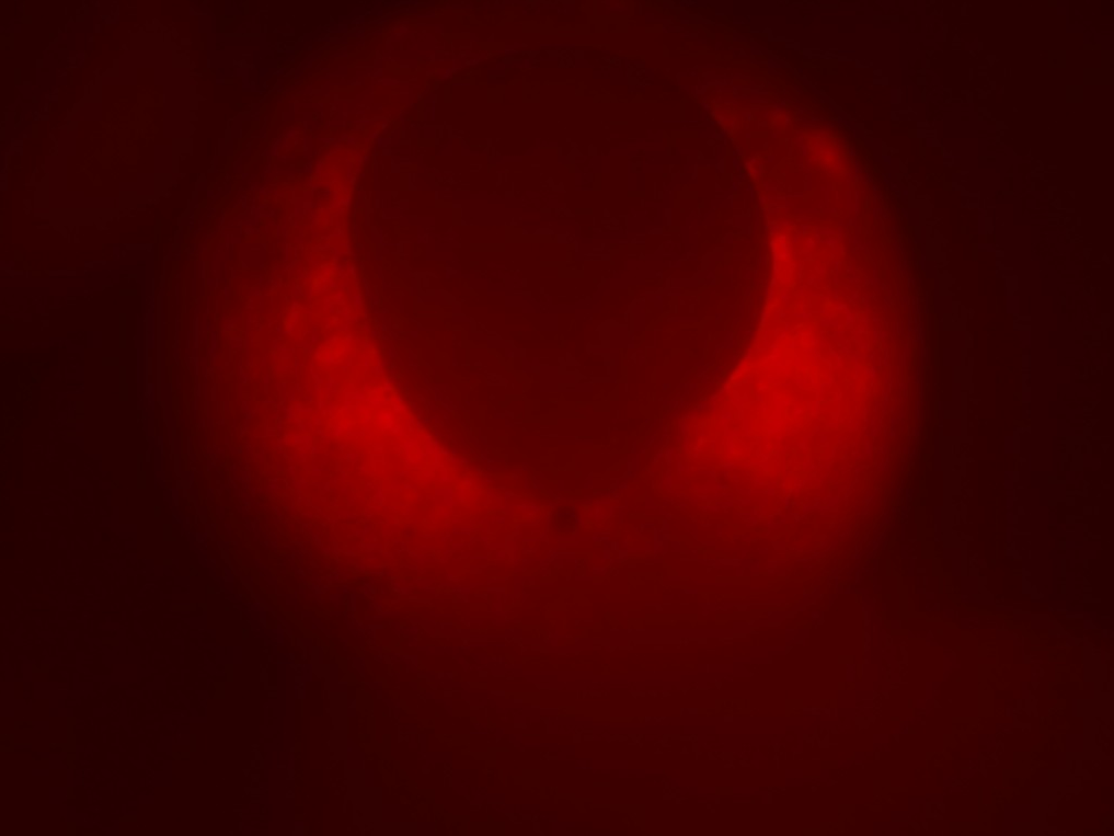 Brachyury-Katushka1EXRC