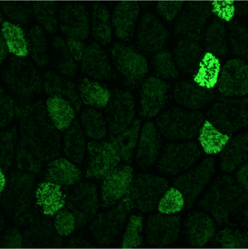 Dira-GFP_3Embryo
