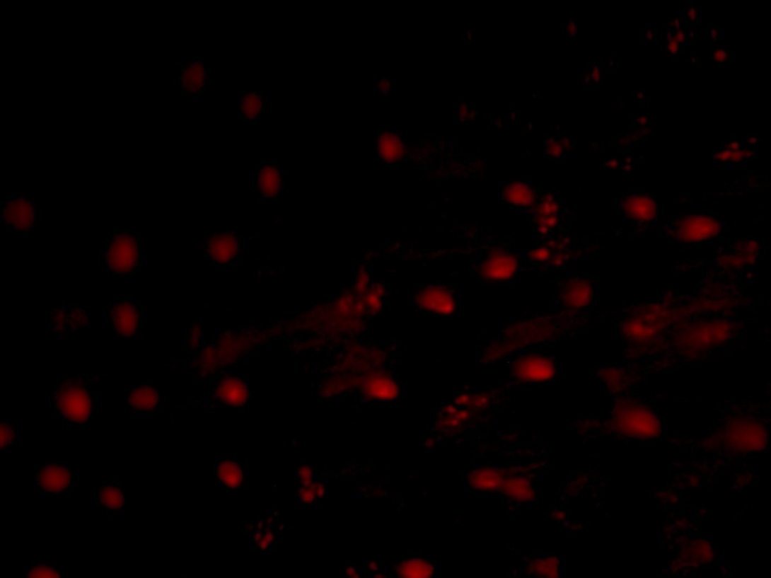 alphatubulinutrrfp_2